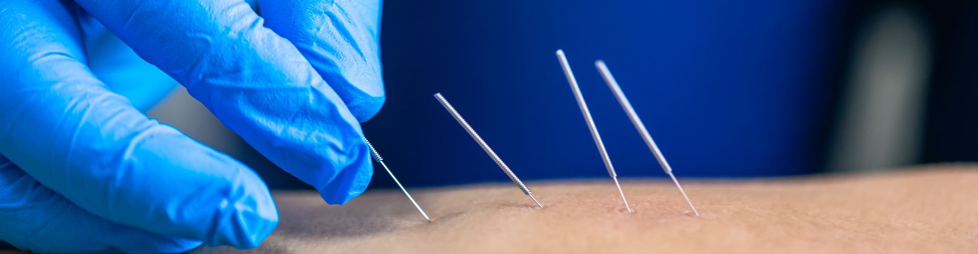 Dry Needling